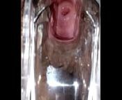 SLIM INDIAN BROWN GIRL CERVIX SPECULUM CHECK VAGINAL OPENING from valve