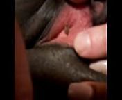 Maggot entering black woman's urethra! from maden