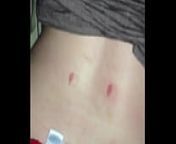 s. woman hickey on back cum shot from back shot s