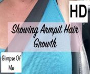 armpit hair even after laser removal - glimpseofme from amitabh aishwarya xxxarm pit hair girls